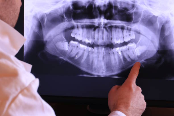 Best Same-Day Emergency Dentist in East Port Orchard, WA