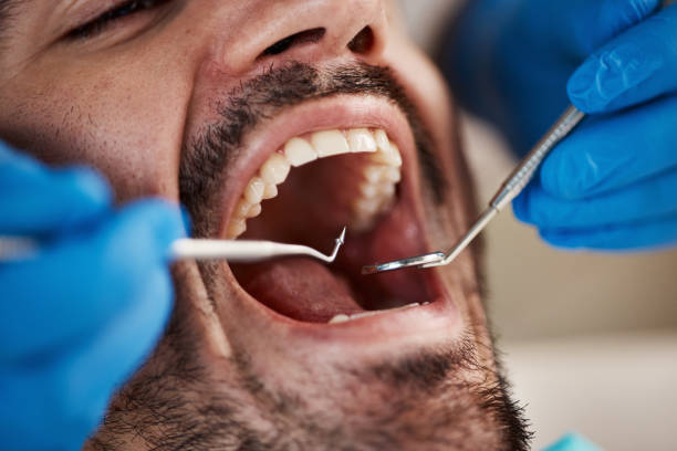 Best Pediatric Emergency Dentist in East Port Orchard, WA
